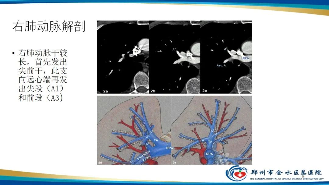 影像PPT - 【PPT】肺动脉CTA扫描技术-9