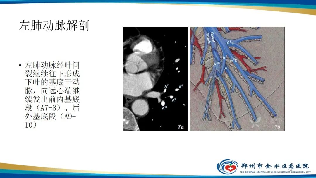 影像PPT - 【PPT】肺动脉CTA扫描技术-14