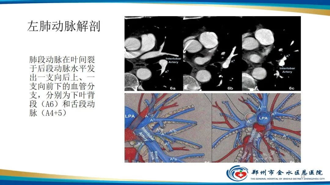影像PPT - 【PPT】肺动脉CTA扫描技术-13