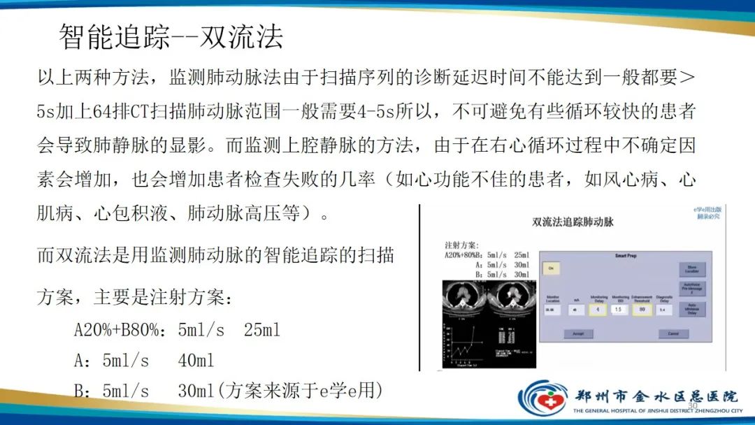 影像PPT - 【PPT】肺动脉CTA扫描技术-30