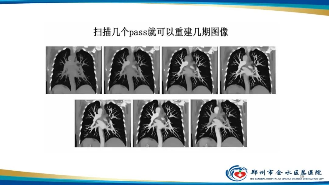 影像PPT - 【PPT】肺动脉CTA扫描技术-39