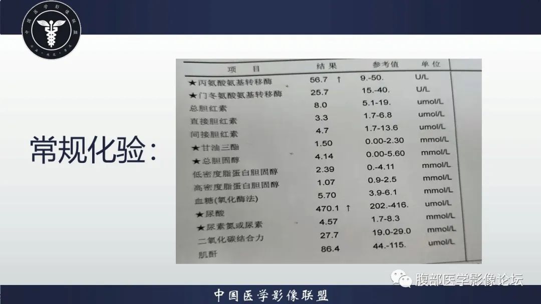 影像PPT - 【病例】十二指肠神经内分泌肿瘤伴肝转移1例CT影像-4 影像PPT - 【病例】十二指肠神经内分泌肿瘤伴肝转移1例CT影像-4