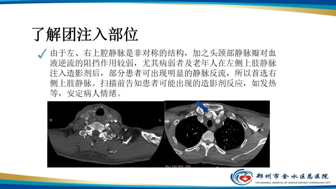 影像PPT - 【PPT】GE64CT的认识与操作-29