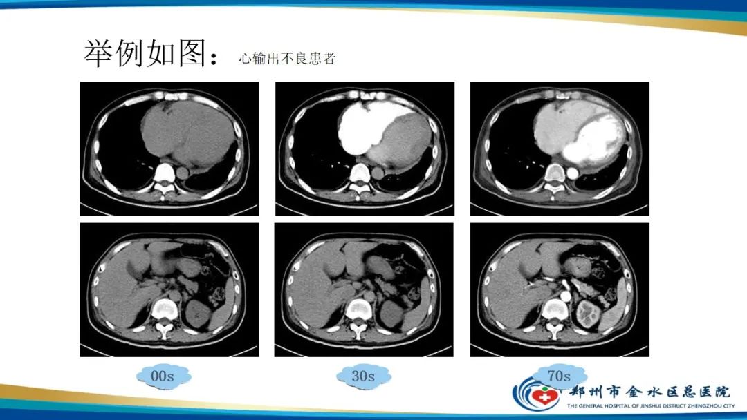 影像PPT - 【PPT】GE64CT的认识与操作-41