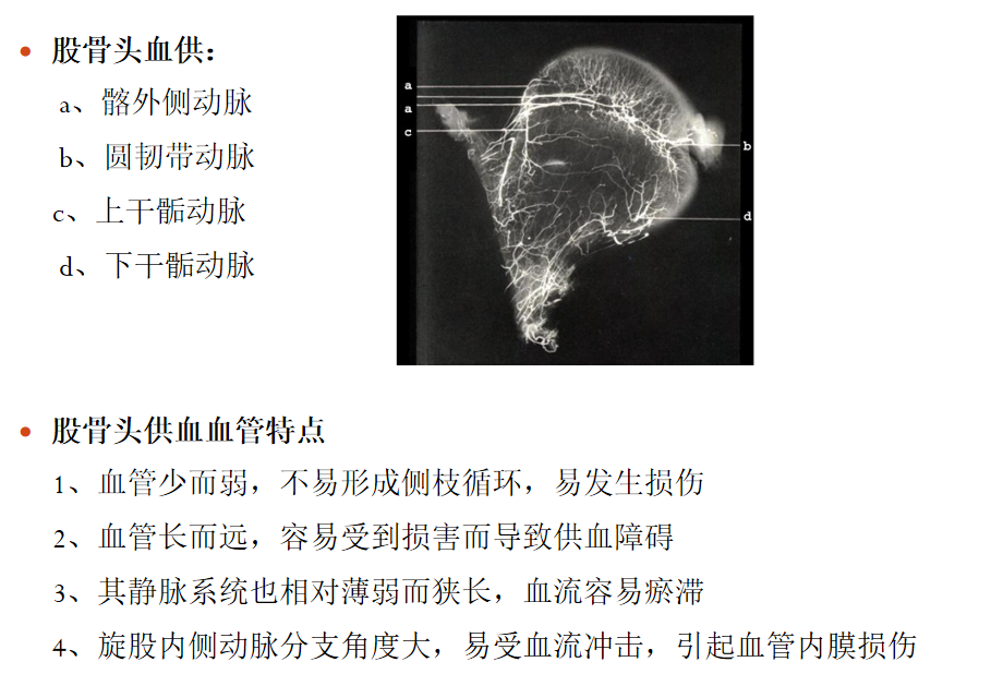 影像PPT - 【PPT】骨缺血坏死的影像诊断-5