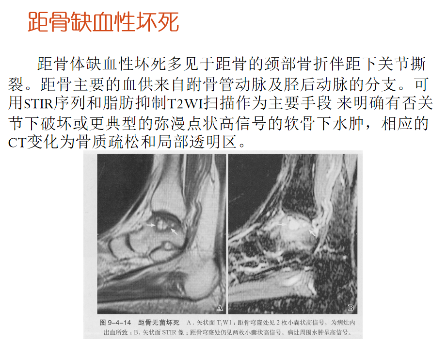 影像PPT - 【PPT】骨缺血坏死的影像诊断-37