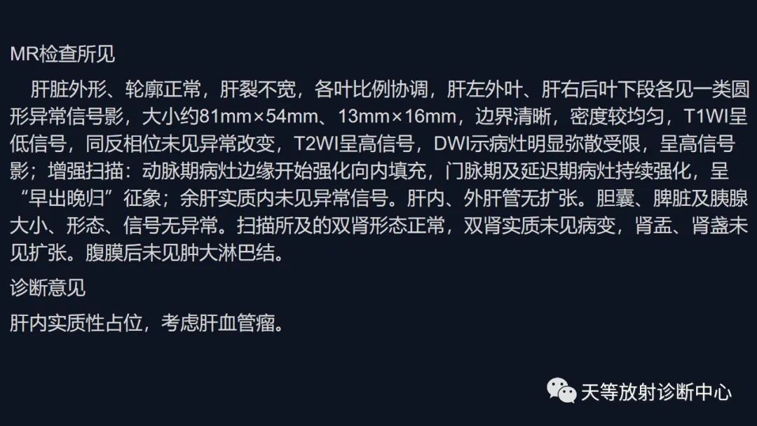 影像PPT - 带你认识灯泡征+早出晚归-25 影像PPT - 带你认识灯泡征+早出晚归-25