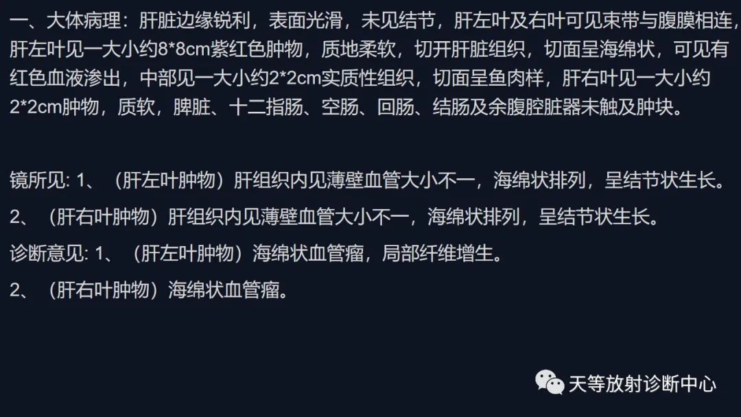 影像PPT - 带你认识灯泡征+早出晚归-28 影像PPT - 带你认识灯泡征+早出晚归-28