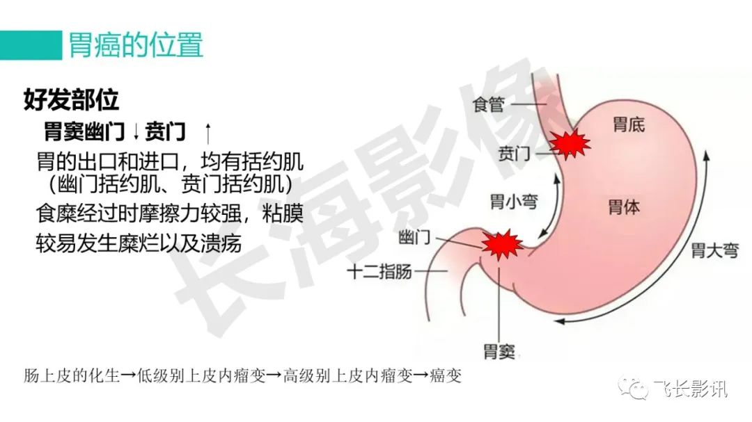 影像PPT - 【PPT】胃癌影像诊断的报告规范-4