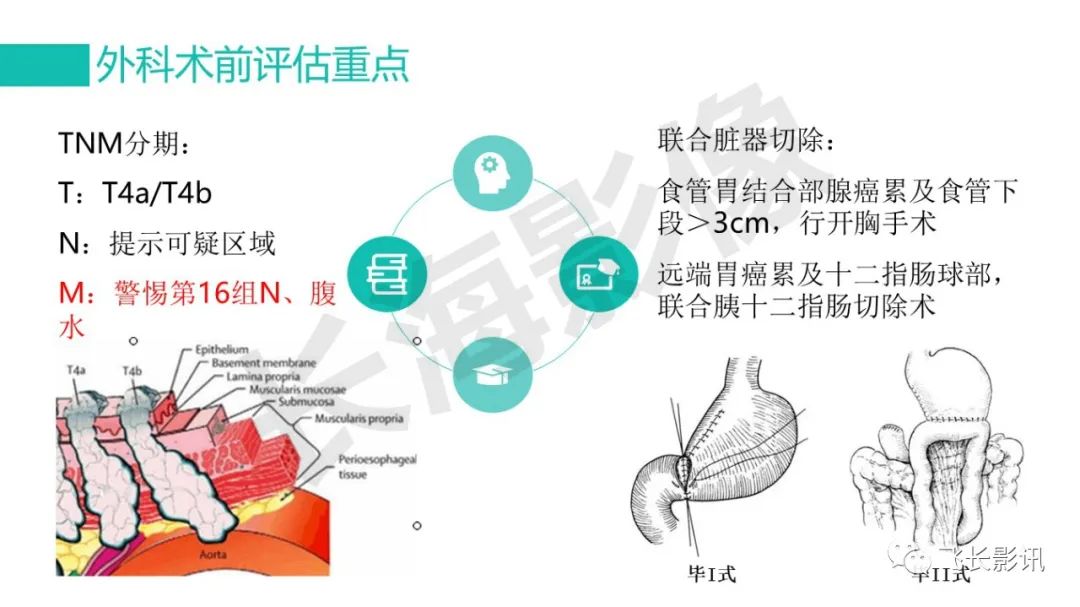 影像PPT - 【PPT】胃癌影像诊断的报告规范-11
