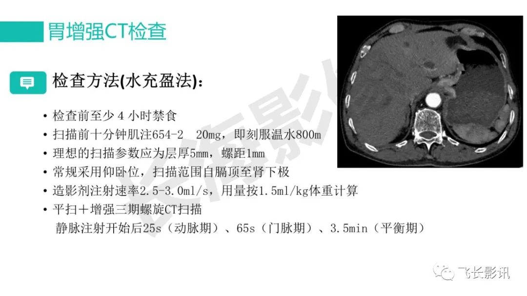 影像PPT - 【PPT】胃癌影像诊断的报告规范-19