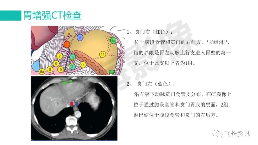 影像PPT - 【PPT】胃癌影像诊断的报告规范-26