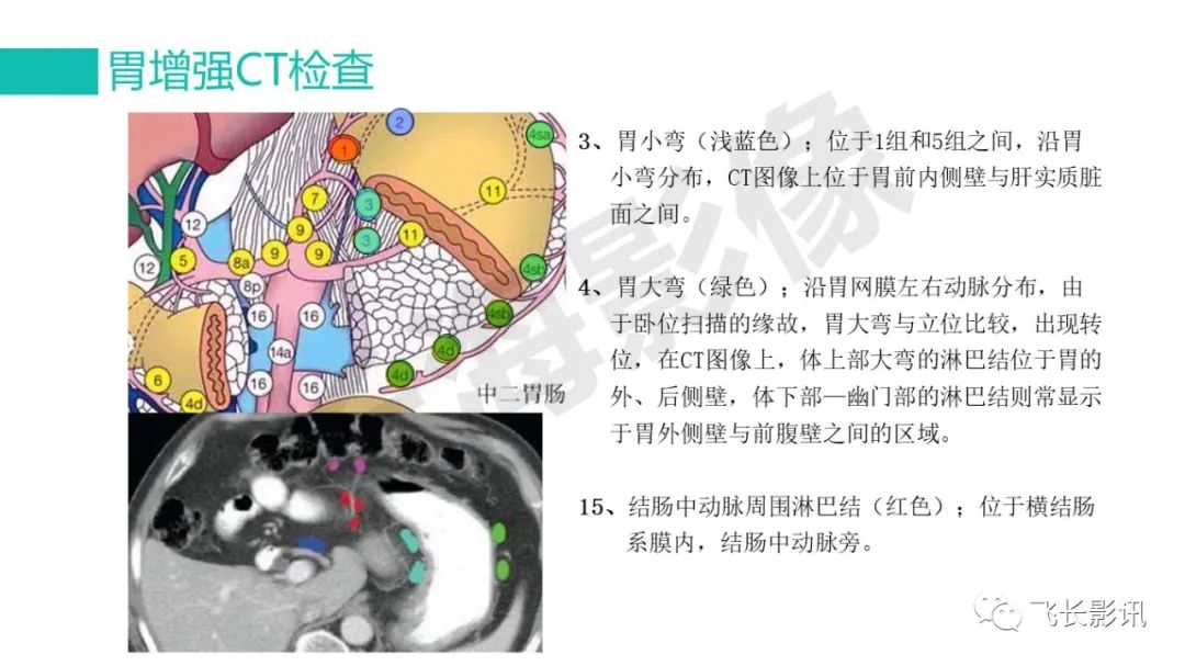 影像PPT - 【PPT】胃癌影像诊断的报告规范-27