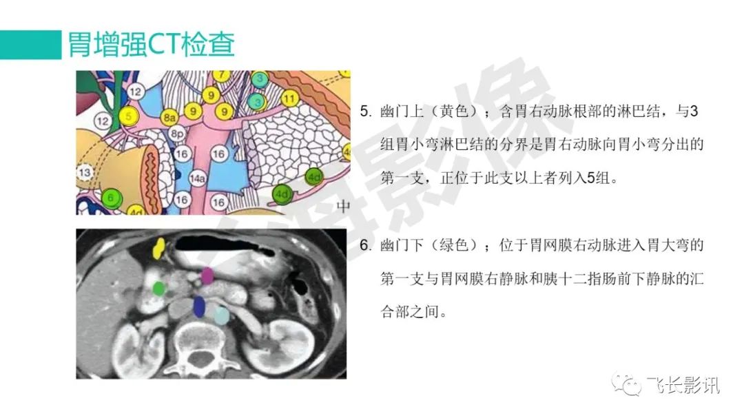 影像PPT - 【PPT】胃癌影像诊断的报告规范-28