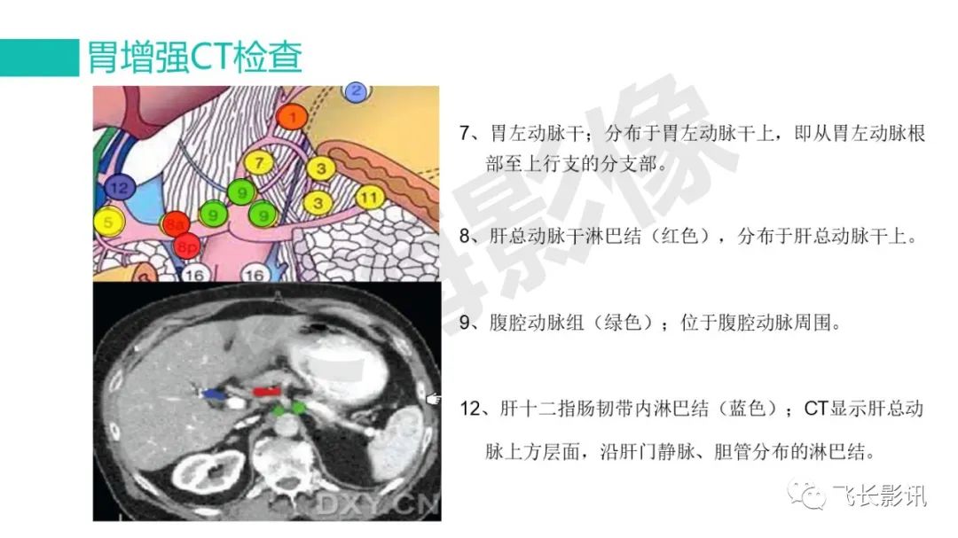 影像PPT - 【PPT】胃癌影像诊断的报告规范-29