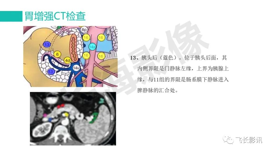 影像PPT - 【PPT】胃癌影像诊断的报告规范-31