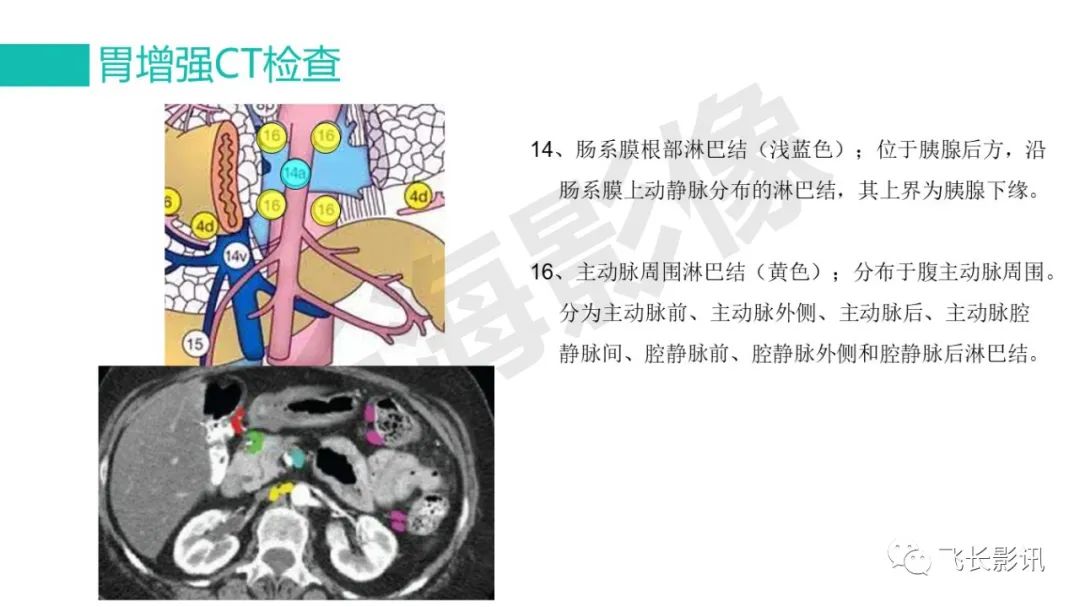 影像PPT - 【PPT】胃癌影像诊断的报告规范-32