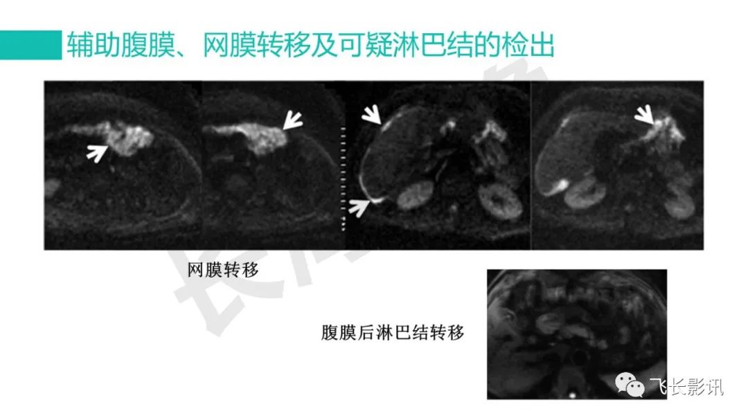 影像PPT - 【PPT】胃癌影像诊断的报告规范-47