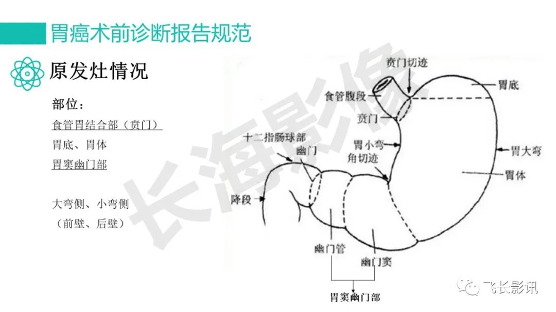 影像PPT - 【PPT】胃癌影像诊断的报告规范-52