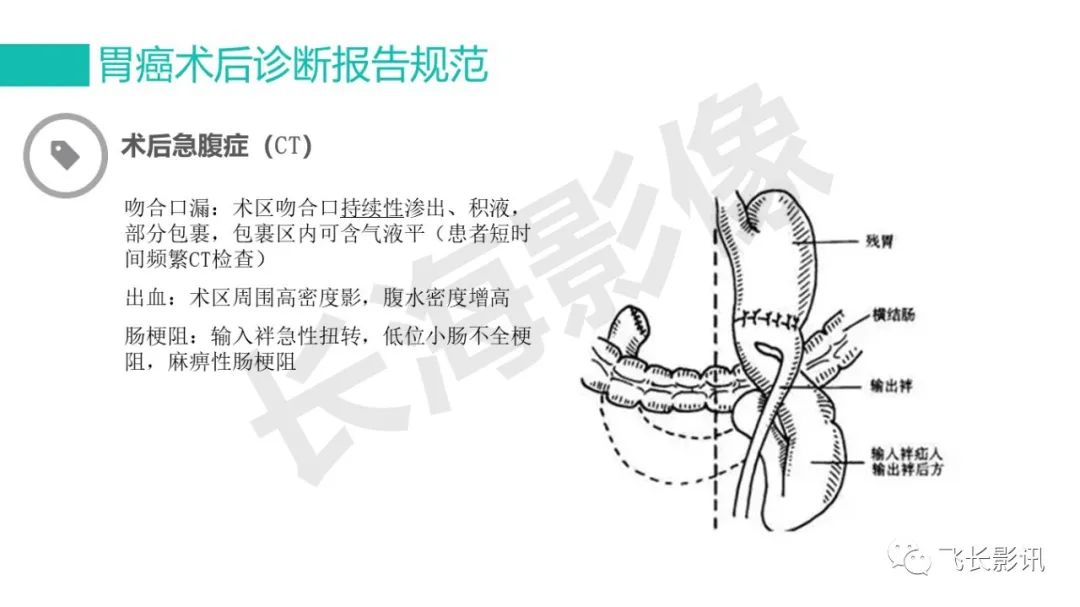 影像PPT - 【PPT】胃癌影像诊断的报告规范-59