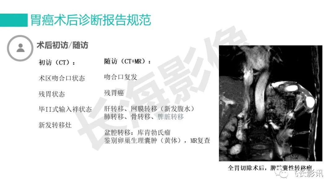 影像PPT - 【PPT】胃癌影像诊断的报告规范-60