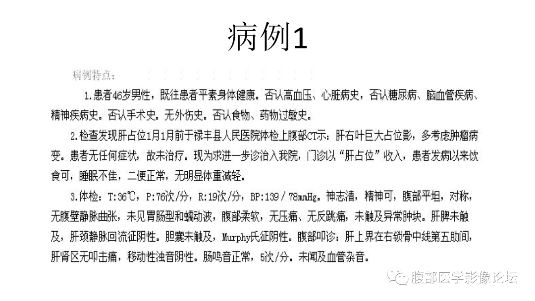 影像PPT - 【病例】肝脏间叶性错构瘤1例CT-2 影像PPT - 【病例】肝脏间叶性错构瘤1例CT-2