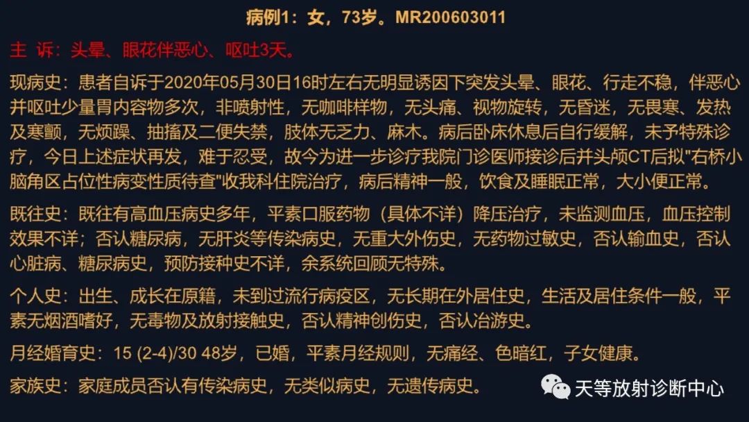 影像PPT - 脑膜瘤影像学分析-1 影像PPT - 脑膜瘤影像学分析-1