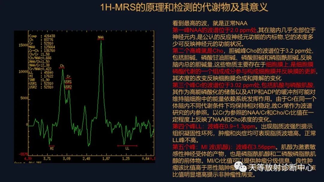 影像PPT - 脑膜瘤影像学分析-26 影像PPT - 脑膜瘤影像学分析-26