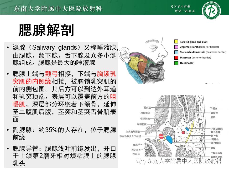 影像PPT - 【PPT】腮腺腺淋巴瘤(Warthin瘤)-6 影像PPT - 【PPT】腮腺腺淋巴瘤(Warthin瘤)-6