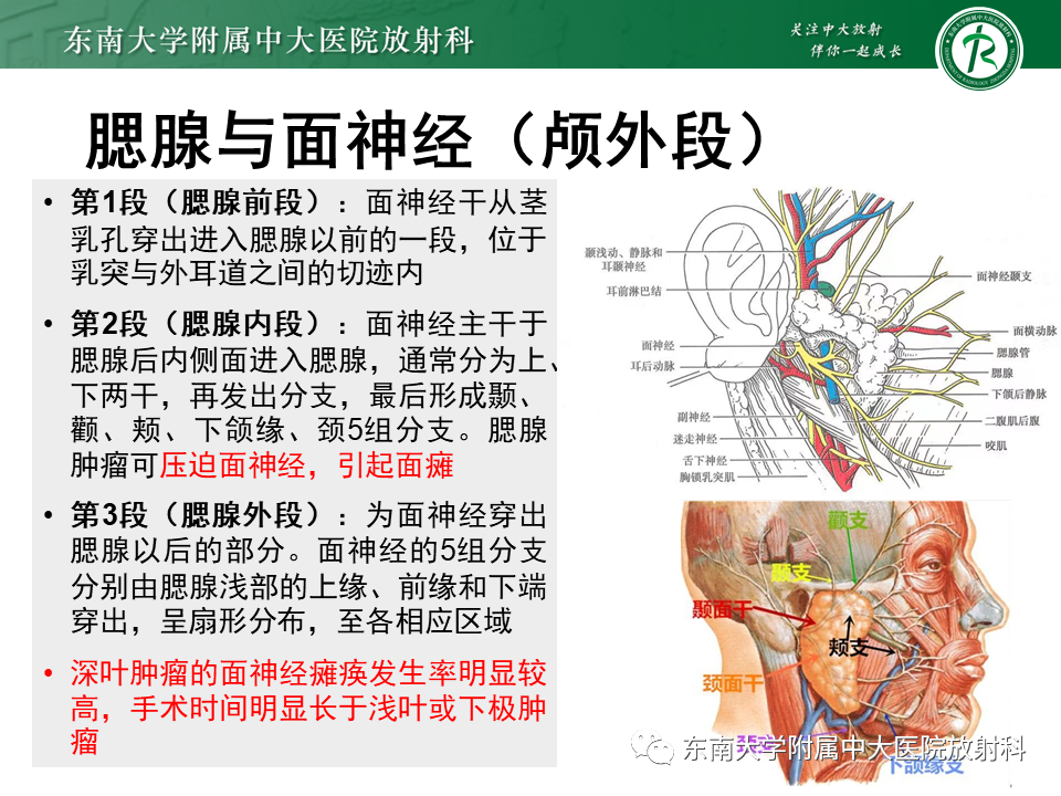 影像PPT - 【PPT】腮腺腺淋巴瘤(Warthin瘤)-7 影像PPT - 【PPT】腮腺腺淋巴瘤(Warthin瘤)-7