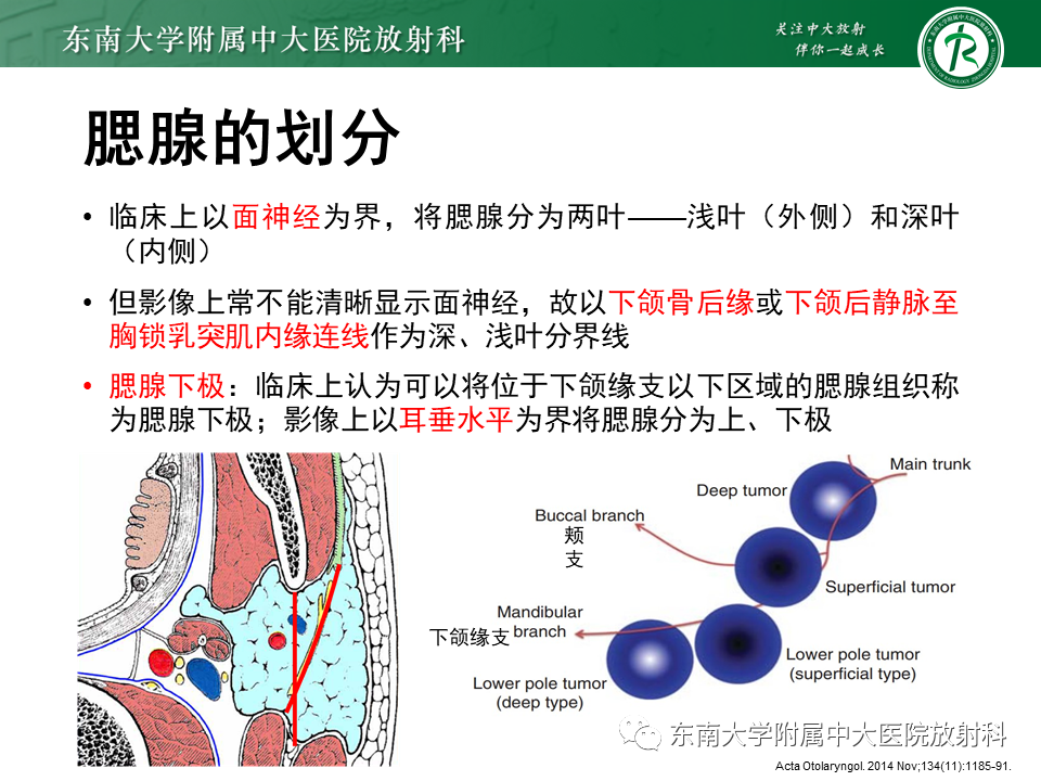 影像PPT - 【PPT】腮腺腺淋巴瘤(Warthin瘤)-8 影像PPT - 【PPT】腮腺腺淋巴瘤(Warthin瘤)-8