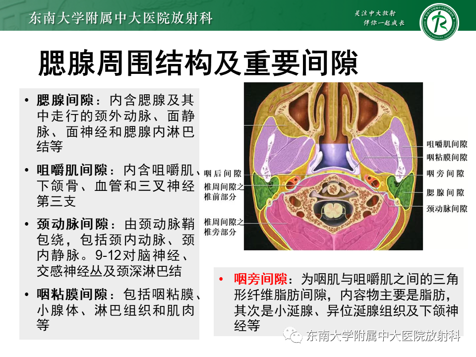 影像PPT - 【PPT】腮腺腺淋巴瘤(Warthin瘤)-10 影像PPT - 【PPT】腮腺腺淋巴瘤(Warthin瘤)-10