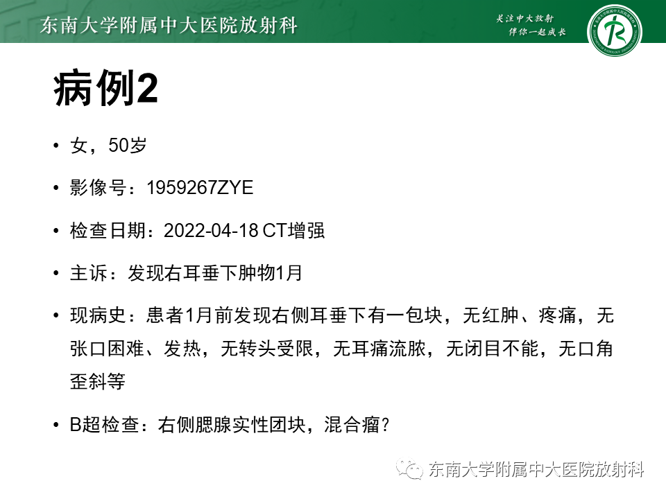 影像PPT - 【PPT】腮腺腺淋巴瘤(Warthin瘤)-25 影像PPT - 【PPT】腮腺腺淋巴瘤(Warthin瘤)-25
