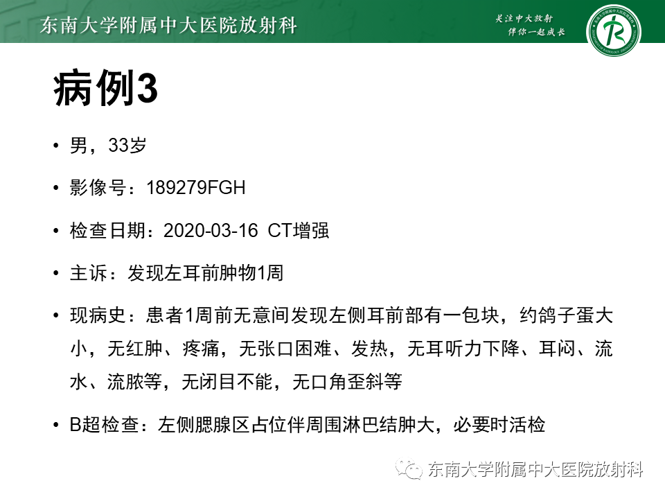影像PPT - 【PPT】腮腺腺淋巴瘤(Warthin瘤)-32 影像PPT - 【PPT】腮腺腺淋巴瘤(Warthin瘤)-32