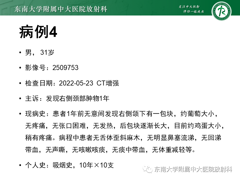 影像PPT - 【PPT】腮腺腺淋巴瘤(Warthin瘤)-37 影像PPT - 【PPT】腮腺腺淋巴瘤(Warthin瘤)-37