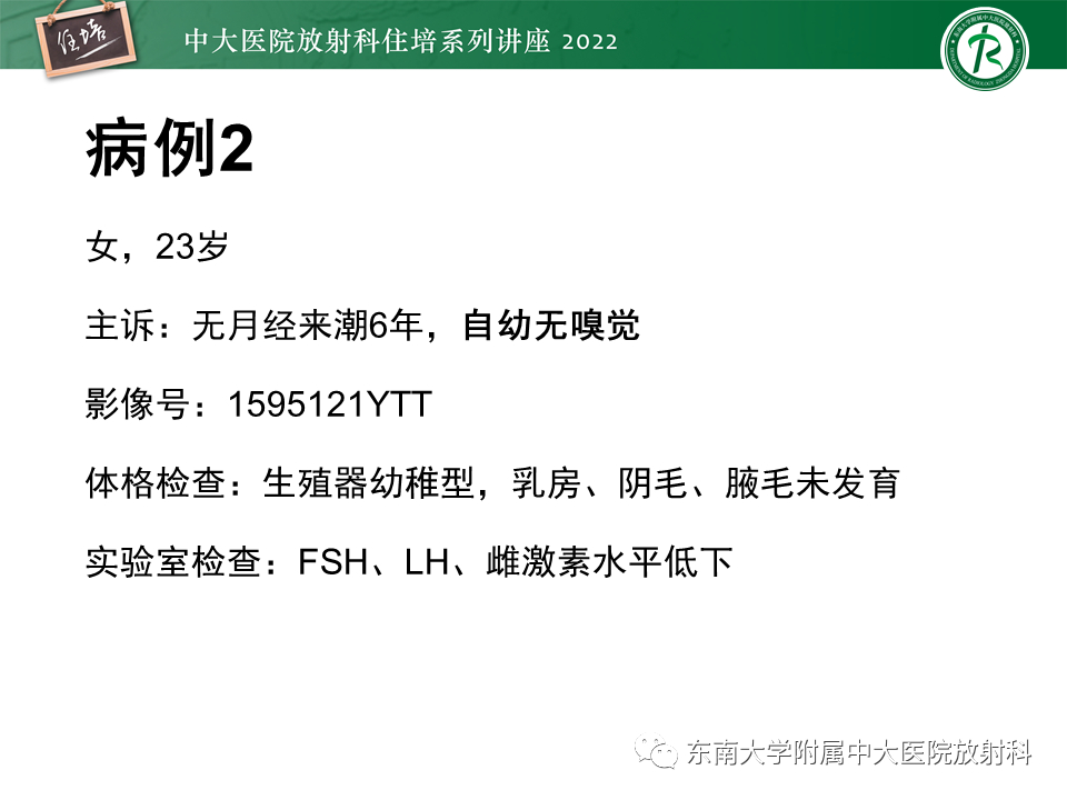 影像PPT - 【PPT】颅神经成像及常见病变-12