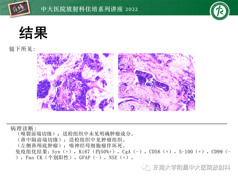 影像PPT - 【PPT】颅神经成像及常见病变-10