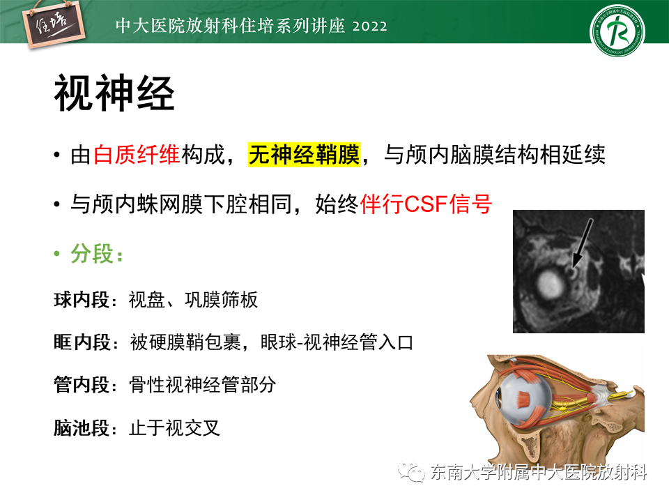 影像PPT - 【PPT】颅神经成像及常见病变-18