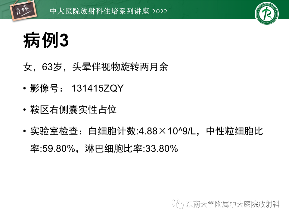 影像PPT - 【PPT】颅神经成像及常见病变-25