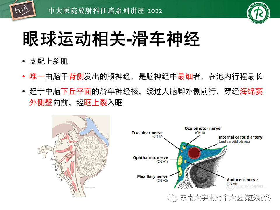 影像PPT - 【PPT】颅神经成像及常见病变-29