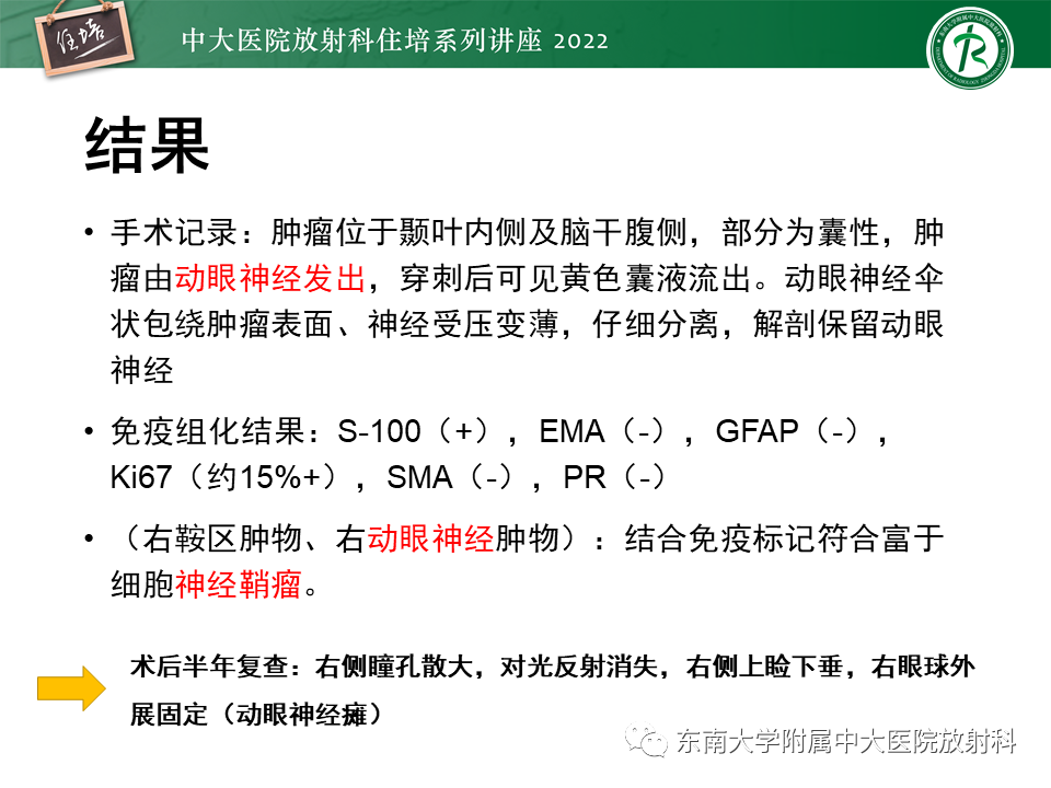 影像PPT - 【PPT】颅神经成像及常见病变-28