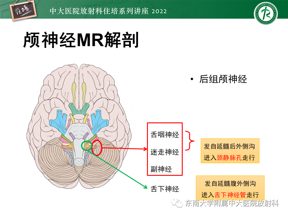 影像PPT - 【PPT】颅神经成像及常见病变-49