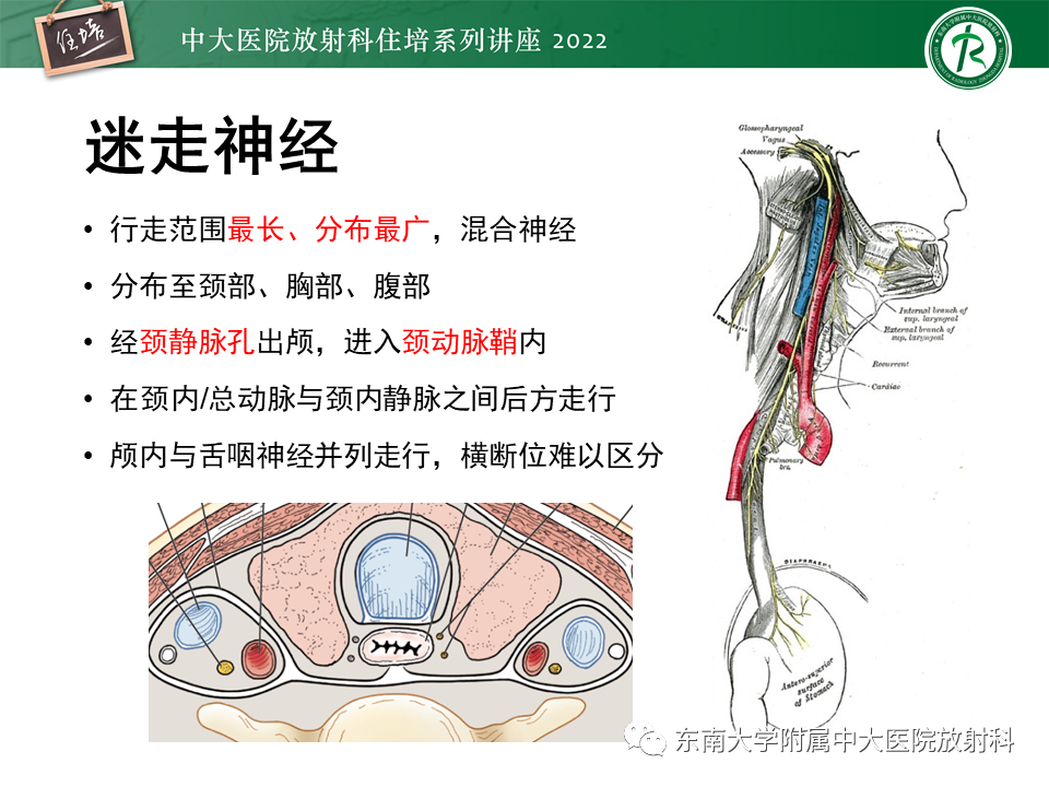 影像PPT - 【PPT】颅神经成像及常见病变-51