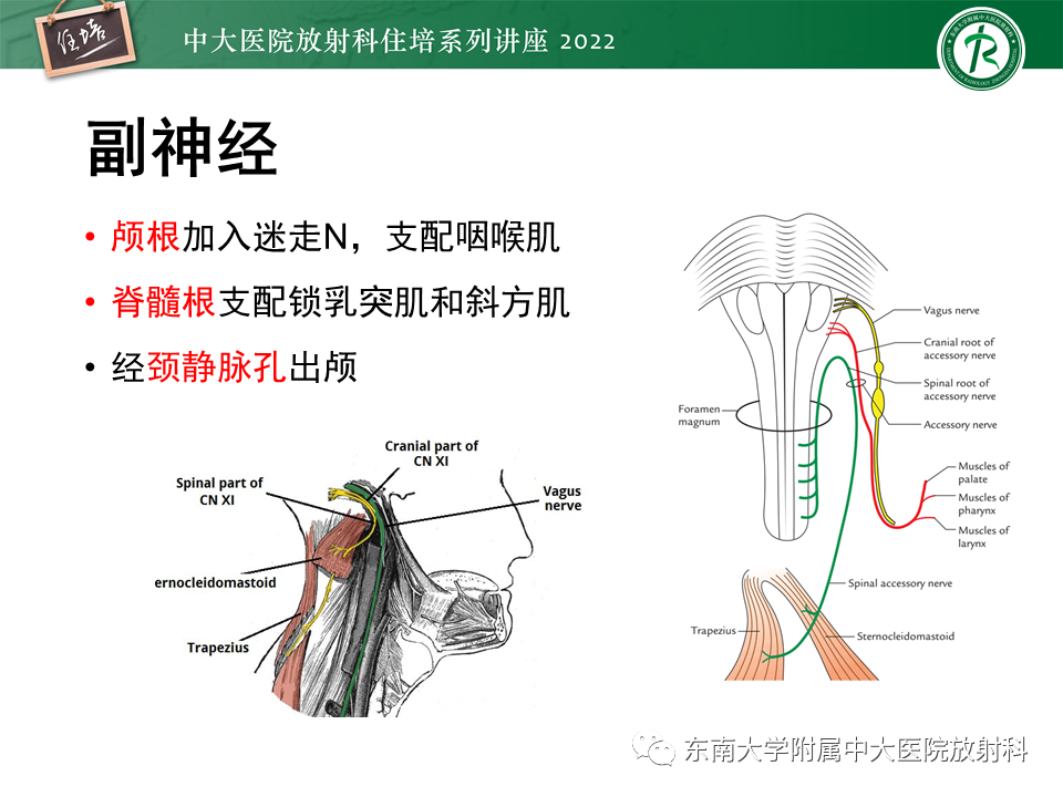 影像PPT - 【PPT】颅神经成像及常见病变-53