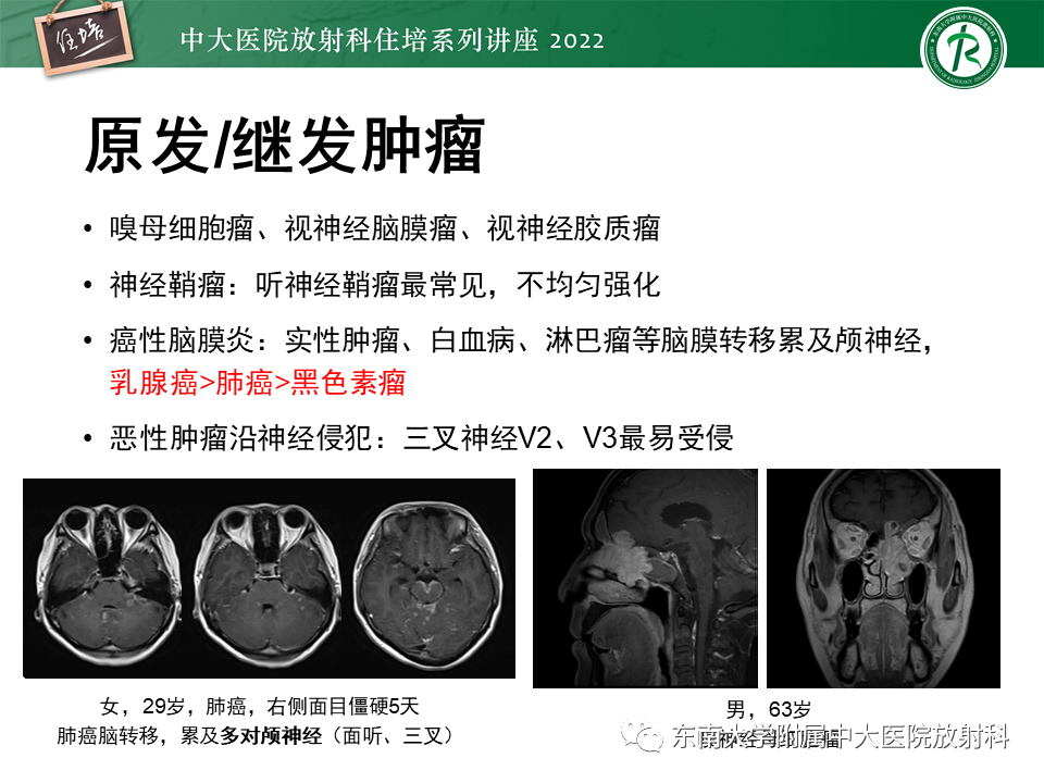 影像PPT - 【PPT】颅神经成像及常见病变-61