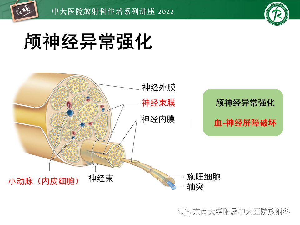 影像PPT - 【PPT】颅神经成像及常见病变-59