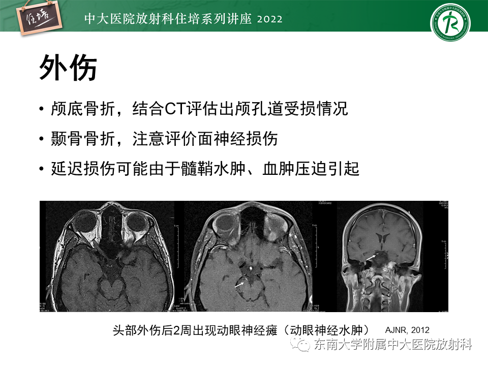 影像PPT - 【PPT】颅神经成像及常见病变-64