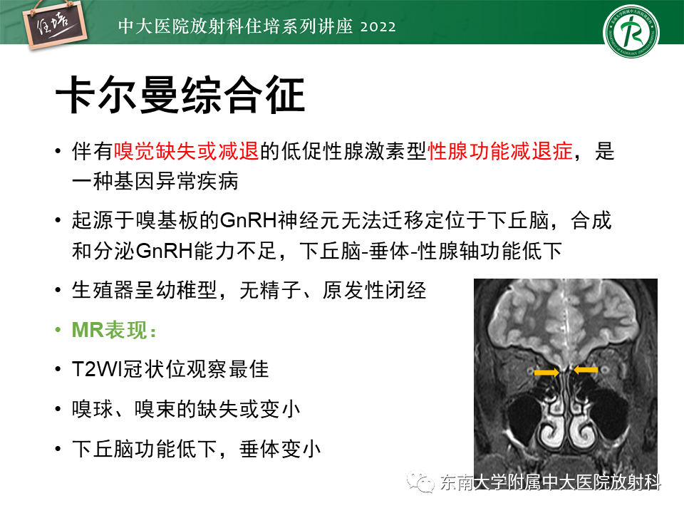 影像PPT - 【PPT】颅神经成像及常见病变-3