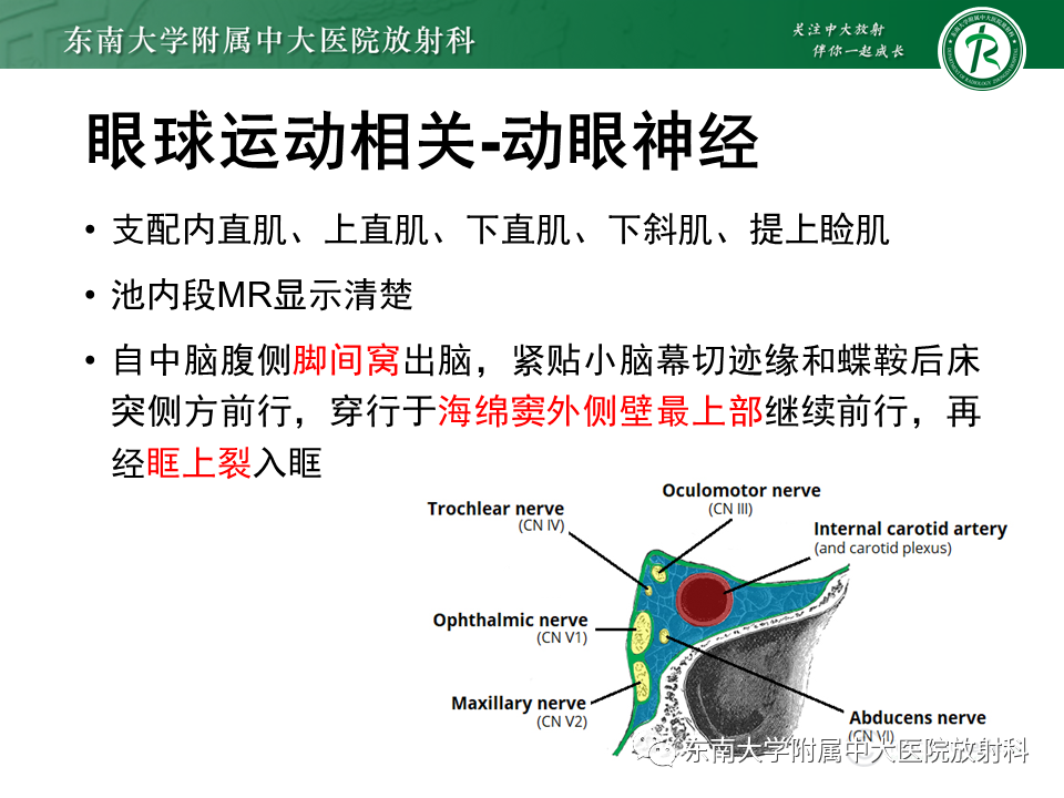影像PPT - 【PPT】颅神经成像及常见病变-4