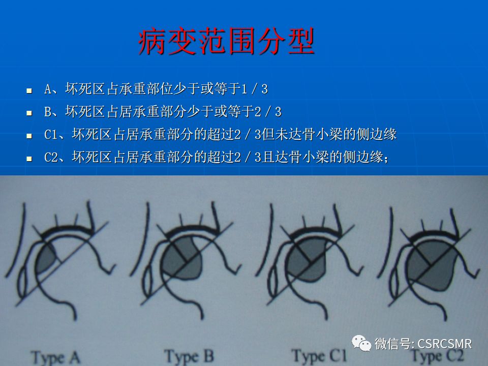 影像PPT - 【PPT】股骨头缺血坏死的大体标本、影像及病理-25